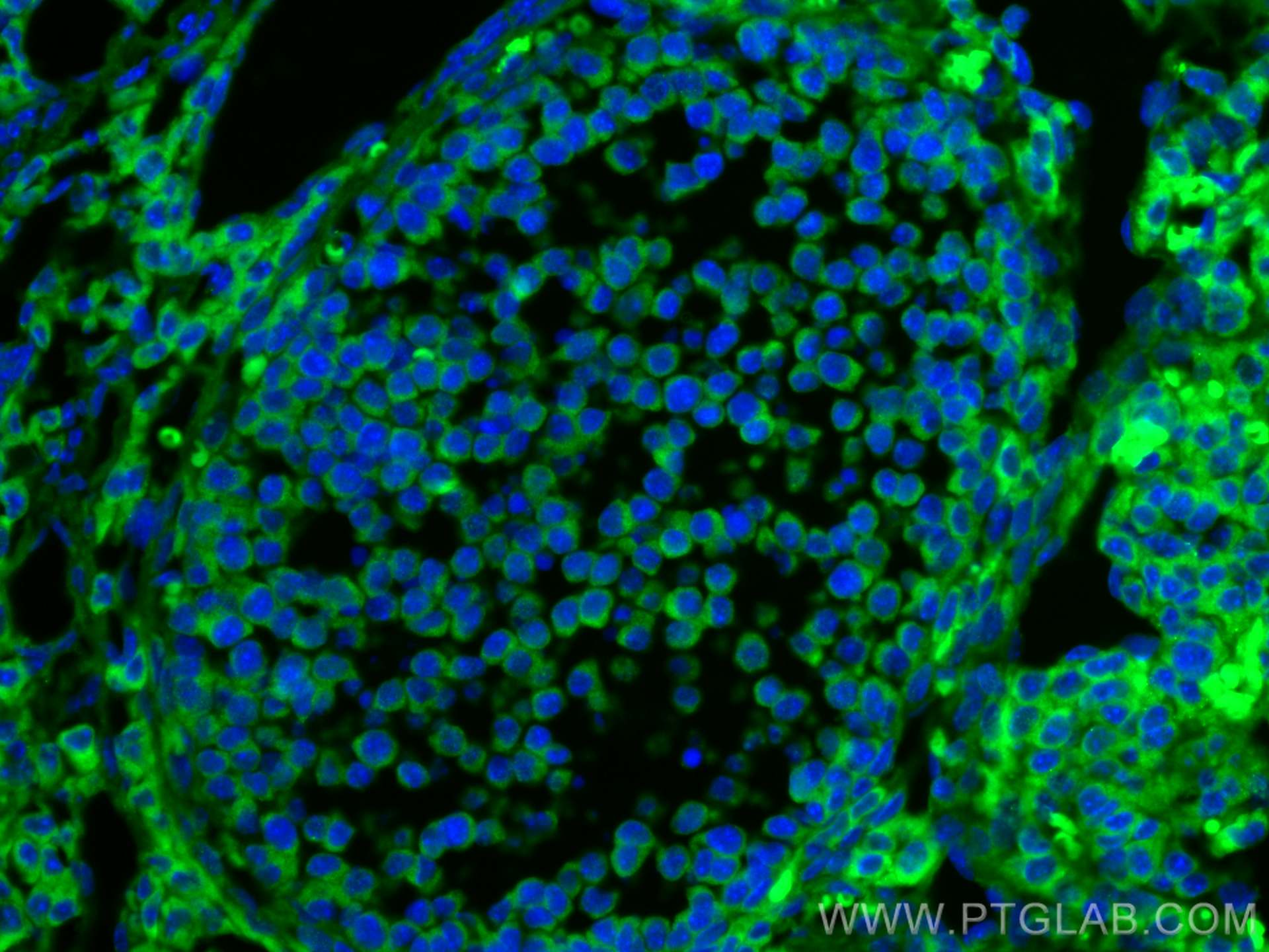 Immunofluorescence (IF) / fluorescent staining of mouse ovary tissue using AMH Polyclonal antibody (23479-1-AP)