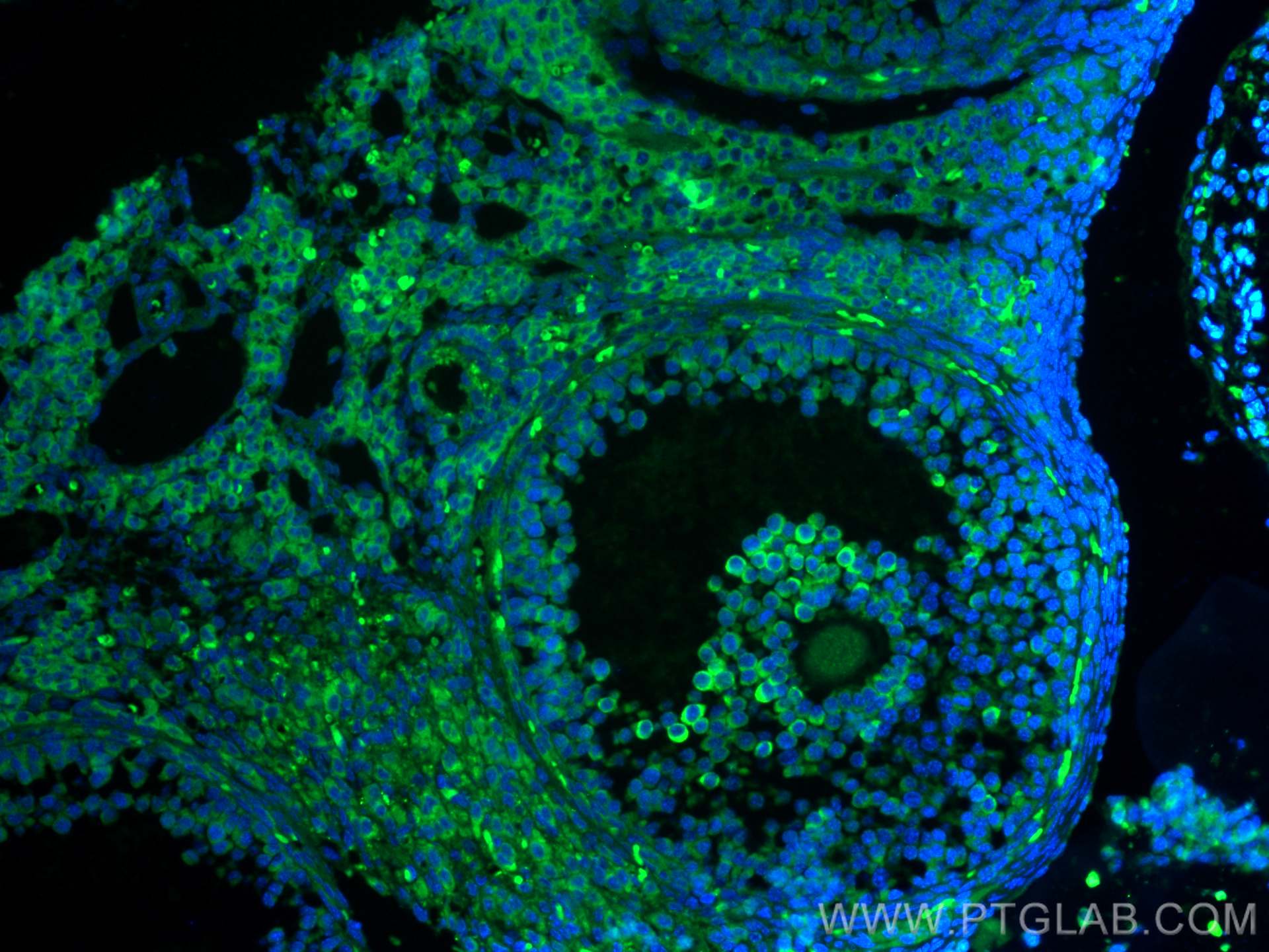 Immunofluorescence (IF) / fluorescent staining of mouse ovary tissue using AMH Polyclonal antibody (23479-1-AP)