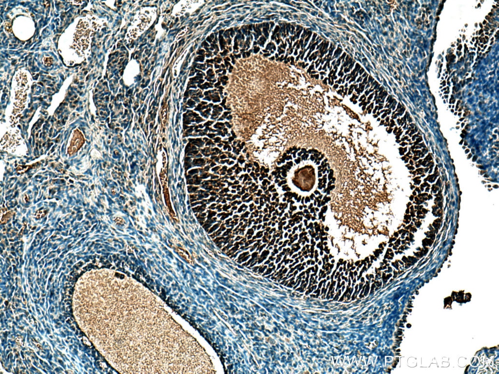 Immunohistochemistry (IHC) staining of rat ovary tissue using AMH Polyclonal antibody (23479-1-AP)
