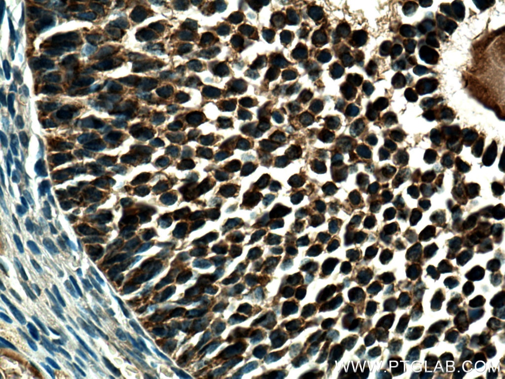 Immunohistochemistry (IHC) staining of rat ovary tissue using AMH Polyclonal antibody (23479-1-AP)