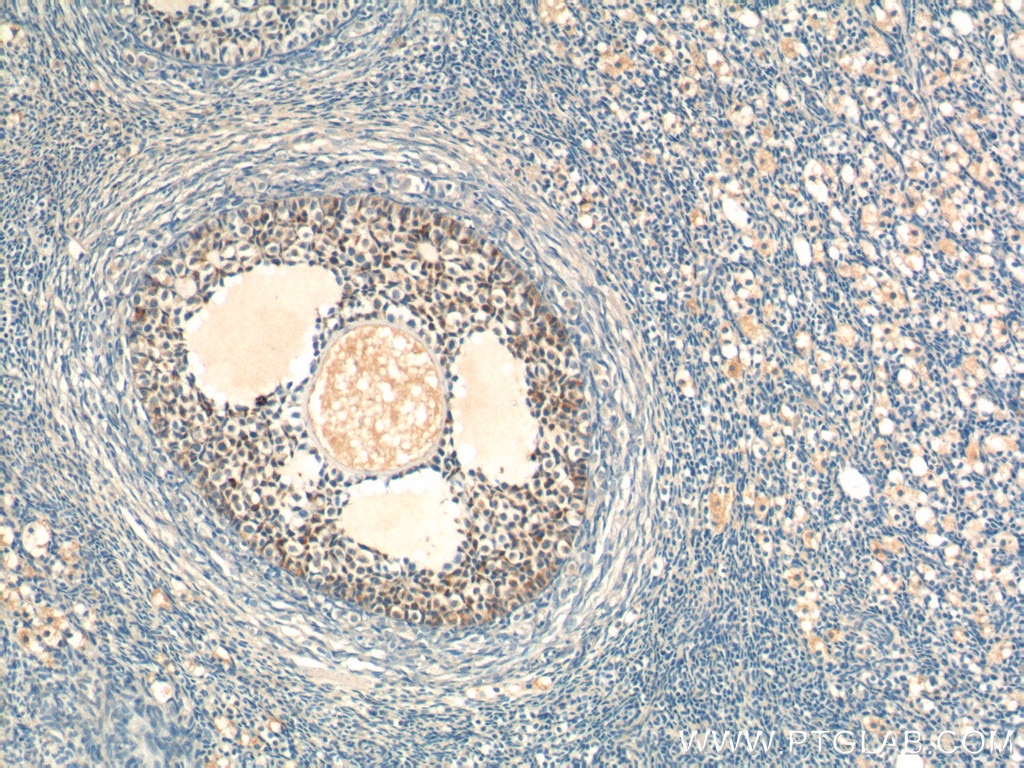 Immunohistochemistry (IHC) staining of human ovary tissue using AMH Polyclonal antibody (23479-1-AP)