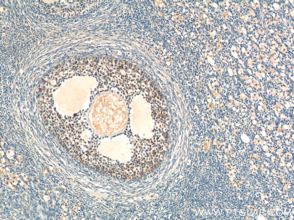 IHC staining of human ovary using 23479-1-AP