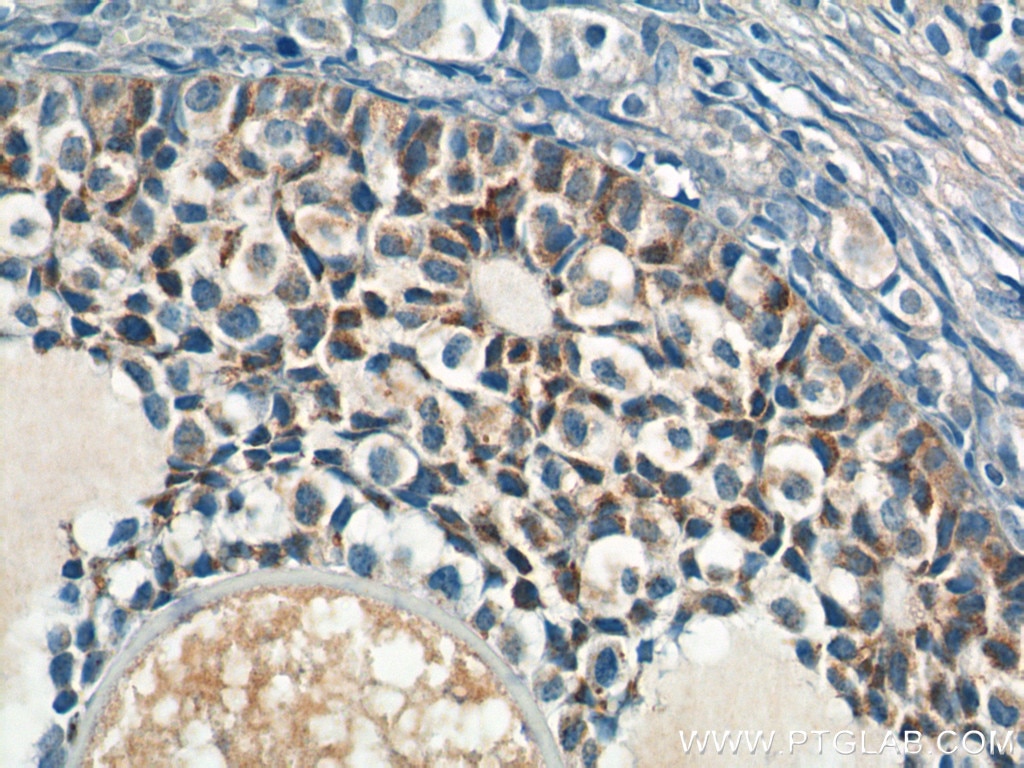 Immunohistochemistry (IHC) staining of human ovary tissue using AMH Polyclonal antibody (23479-1-AP)