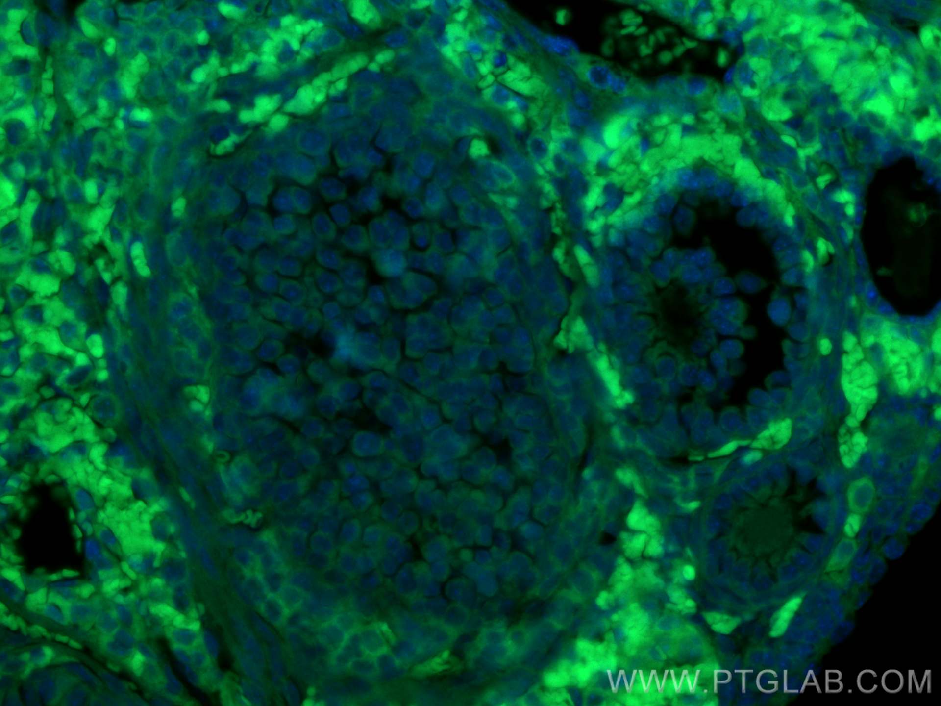 Immunofluorescence (IF) / fluorescent staining of mouse ovary tissue using CoraLite® Plus 488-conjugated AMH Polyclonal antib (CL488-14461)