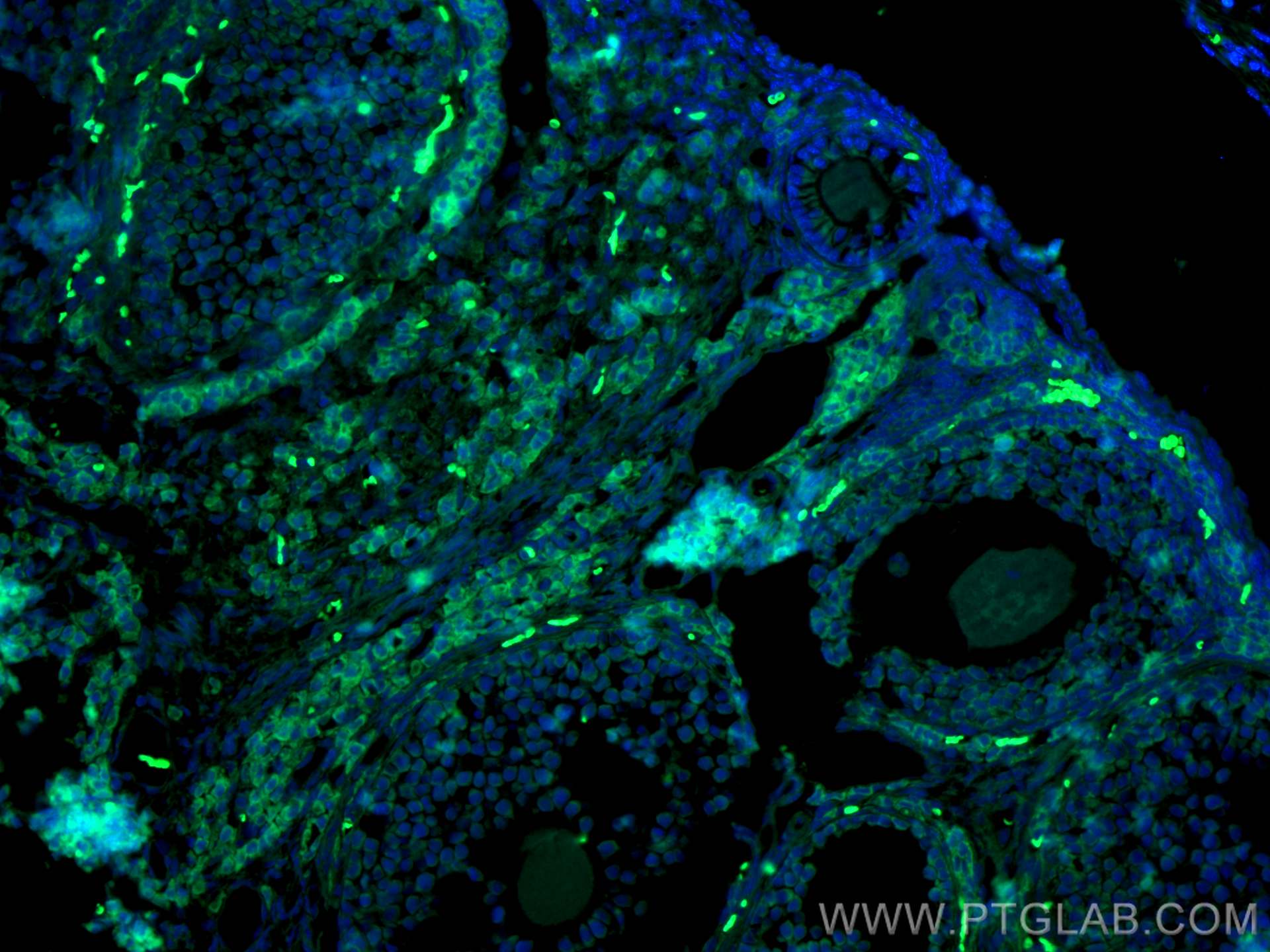 Immunofluorescence (IF) / fluorescent staining of mouse ovary tissue using CoraLite® Plus 488-conjugated AMH Polyclonal antib (CL488-23479)