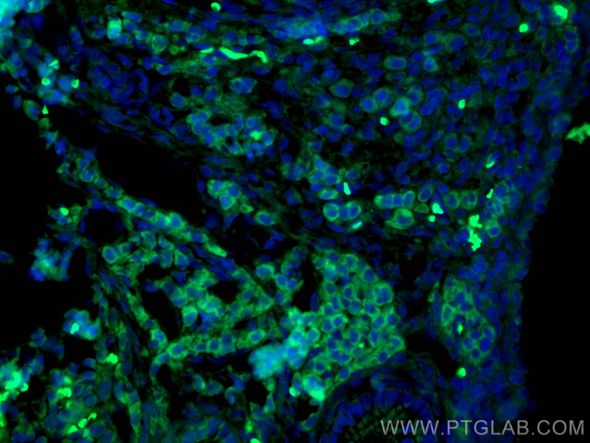 Immunofluorescence (IF) / fluorescent staining of mouse ovary tissue using CoraLite® Plus 488-conjugated AMH Polyclonal antib (CL488-23479)