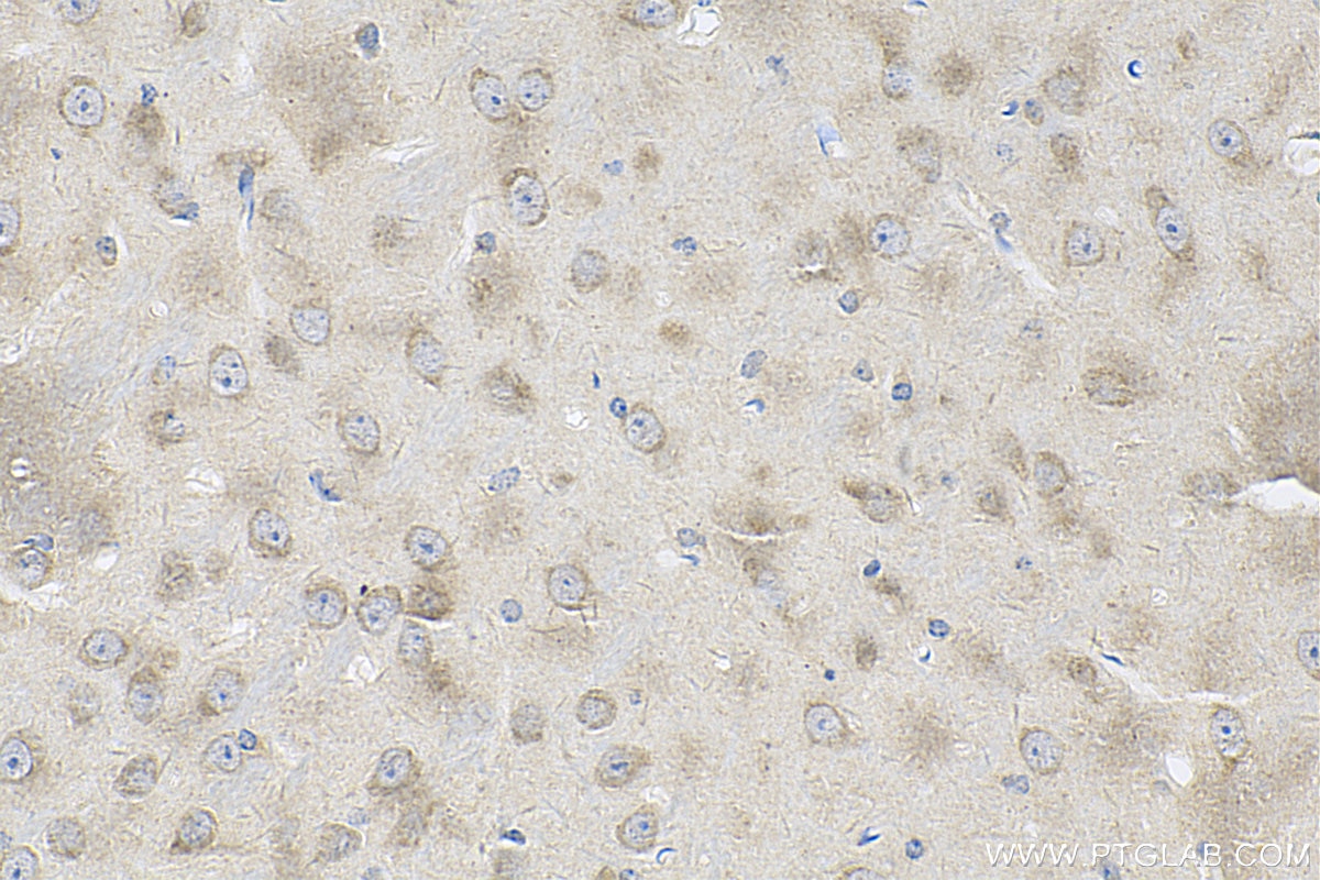 Immunohistochemistry (IHC) staining of mouse brain tissue using AMHR2 Polyclonal antibody (25888-1-AP)