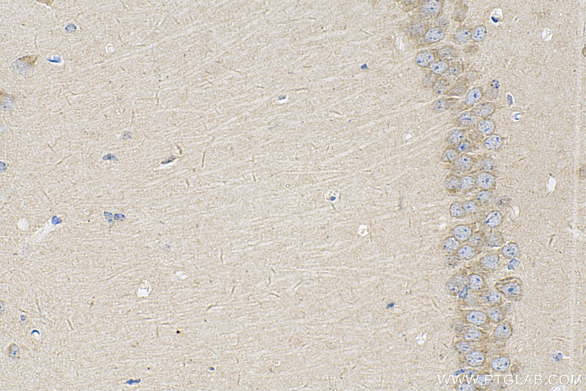 Immunohistochemistry (IHC) staining of mouse brain tissue using AMHR2 Polyclonal antibody (25888-1-AP)