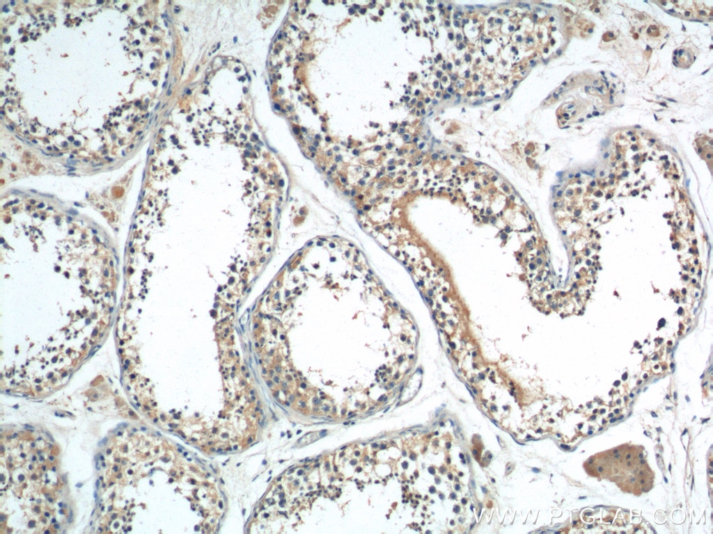 Immunohistochemistry (IHC) staining of human testis tissue using AMHR2 Polyclonal antibody (25888-1-AP)
