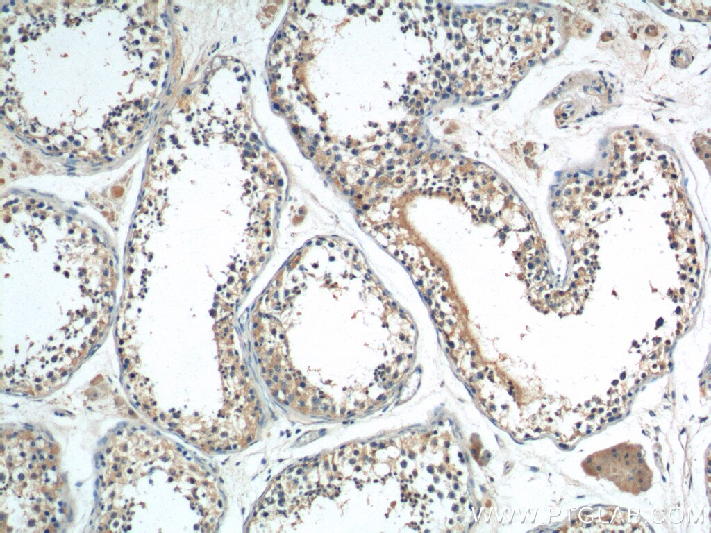 IHC staining of human testis using 25888-1-AP