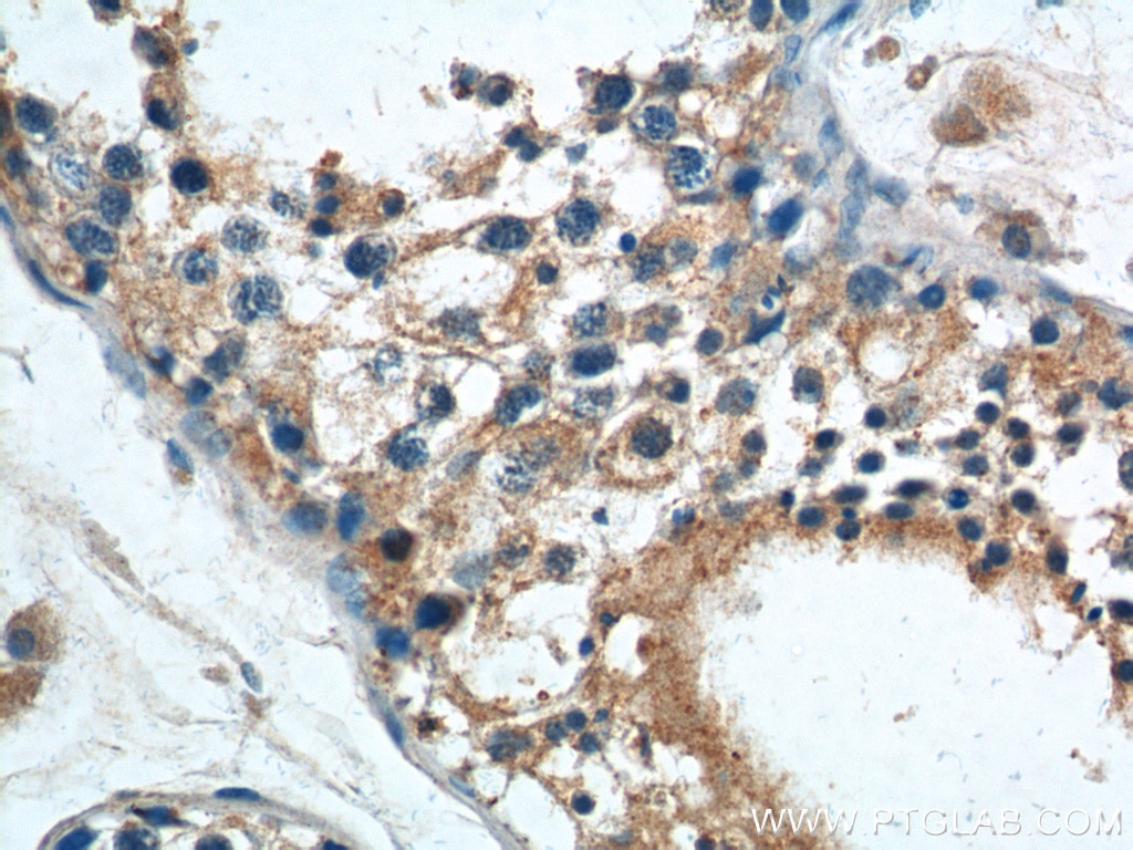 IHC staining of human testis using 25888-1-AP