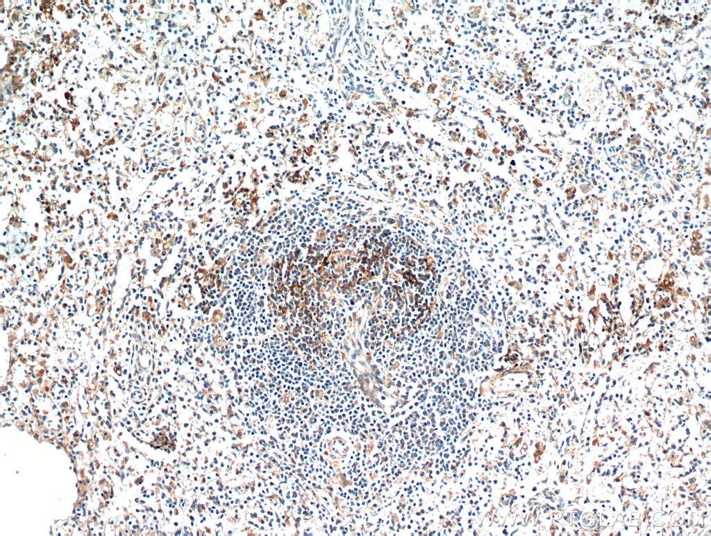 Immunohistochemistry (IHC) staining of human spleen tissue using JAML Polyclonal antibody (21302-1-AP)