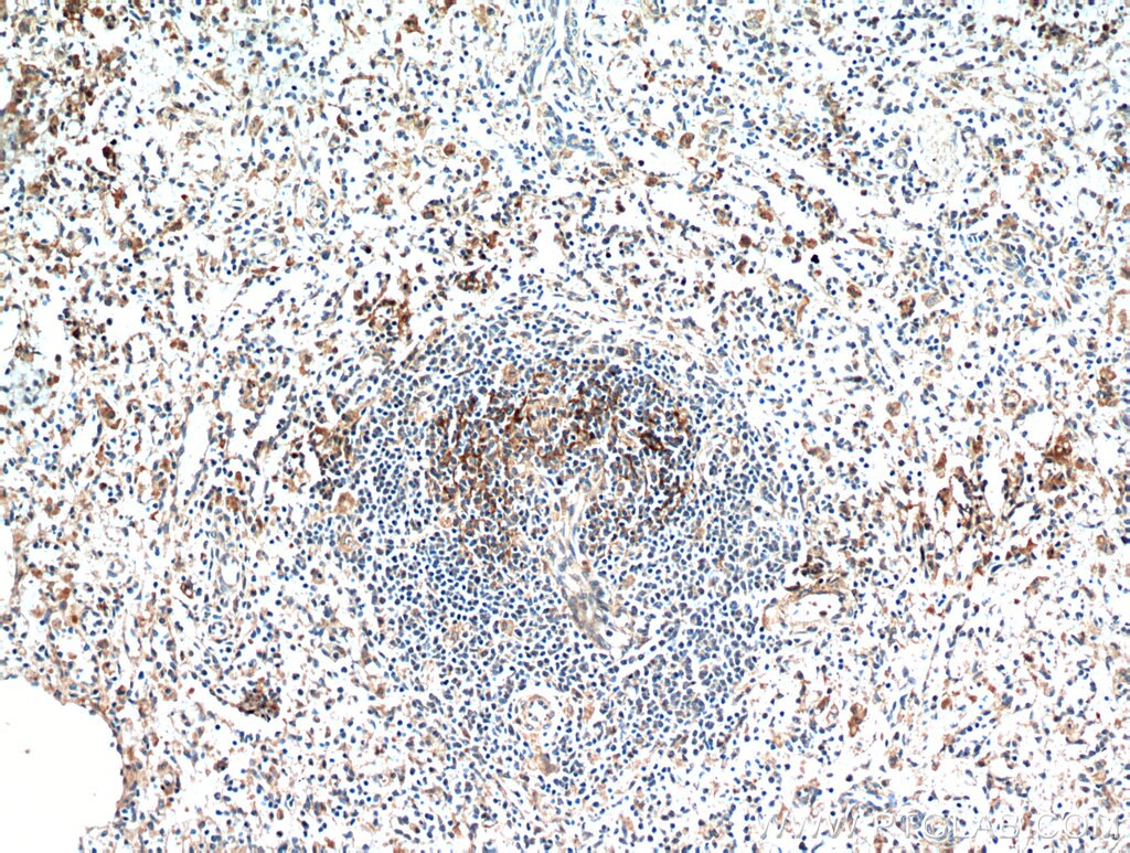 IHC staining of human spleen using 21302-1-AP