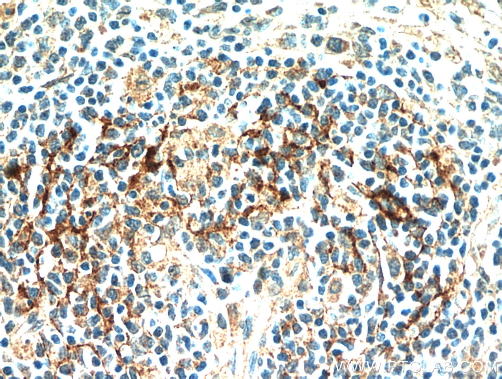 Immunohistochemistry (IHC) staining of human spleen tissue using JAML Polyclonal antibody (21302-1-AP)