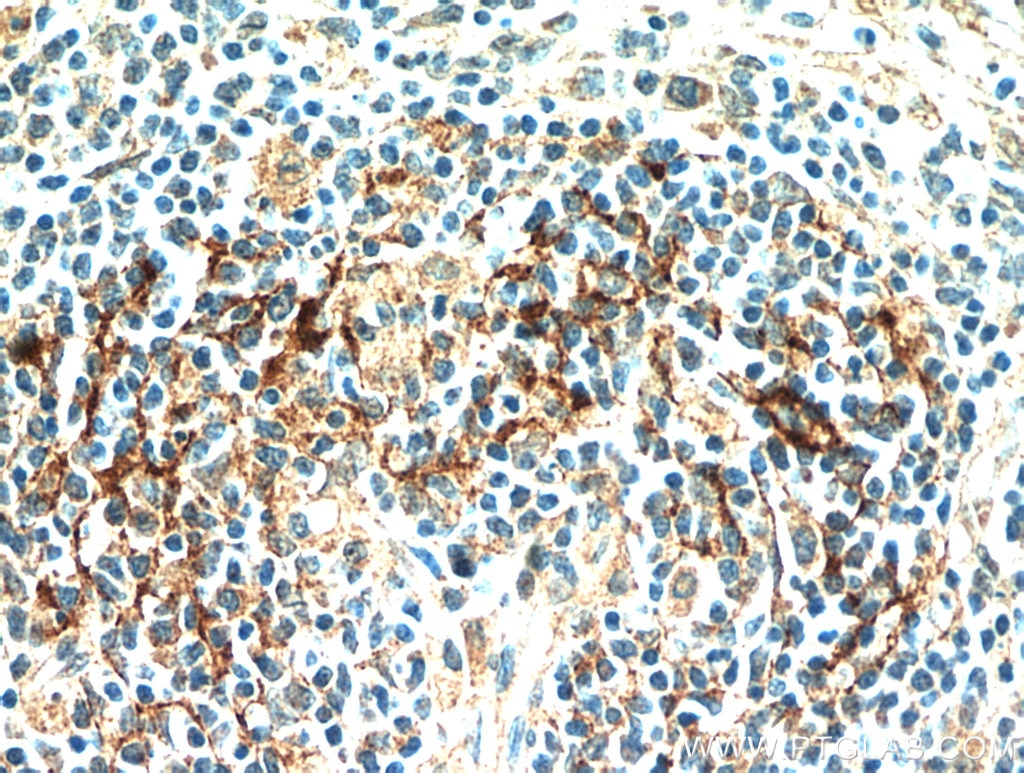 Immunohistochemistry (IHC) staining of human spleen tissue using JAML Polyclonal antibody (21302-1-AP)