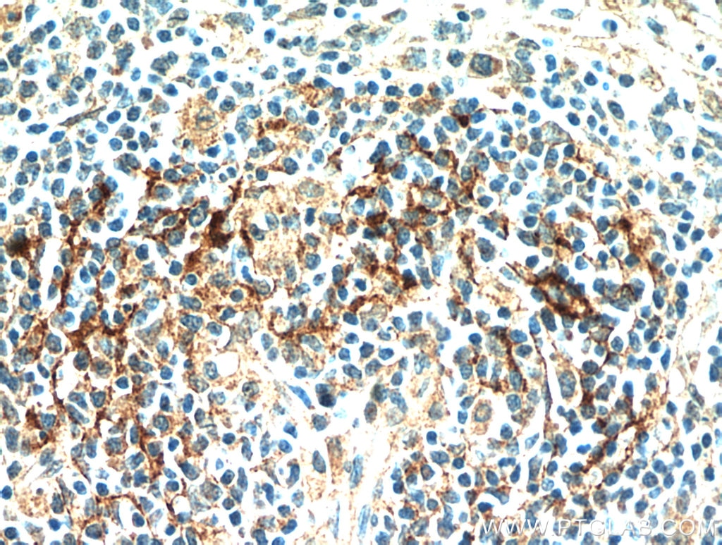 IHC staining of human spleen using 21302-1-AP