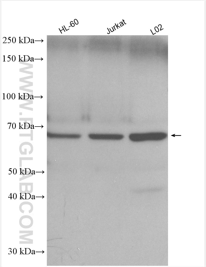 Western Blot (WB) analysis of various lysates using JAML Polyclonal antibody (21302-1-AP)
