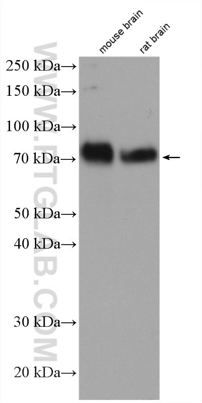 Western Blot (WB) analysis of mouse brain tissue using AMIGO1 Polyclonal antibody (21874-1-AP)