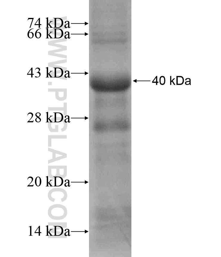 AMIGO1 fusion protein Ag17121 SDS-PAGE