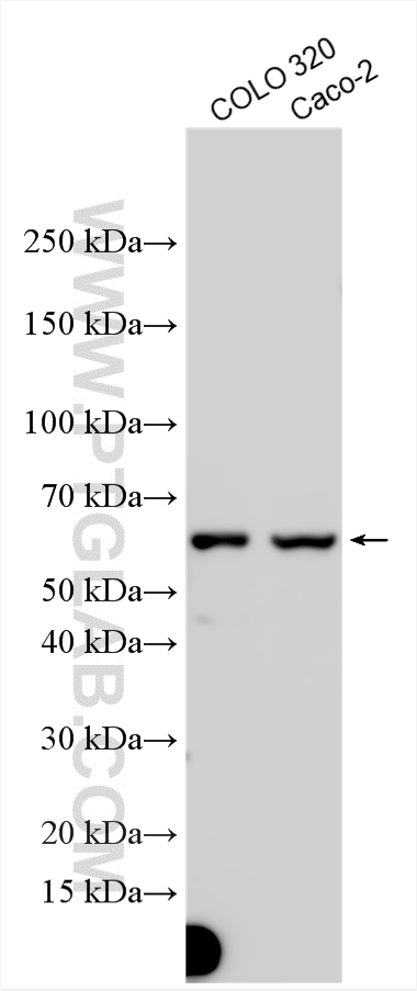 Western Blot (WB) analysis of various lysates using AMIGO2 Polyclonal antibody (14076-1-AP)