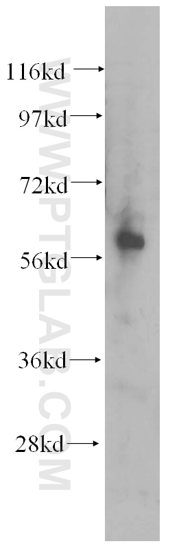 Western Blot (WB) analysis of Y79 cells using AMIGO2 Polyclonal antibody (14076-1-AP)