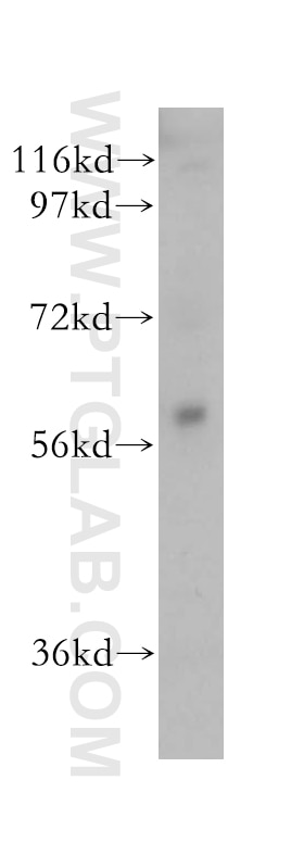 Western Blot (WB) analysis of K-562 cells using AMIGO2 Polyclonal antibody (14076-1-AP)