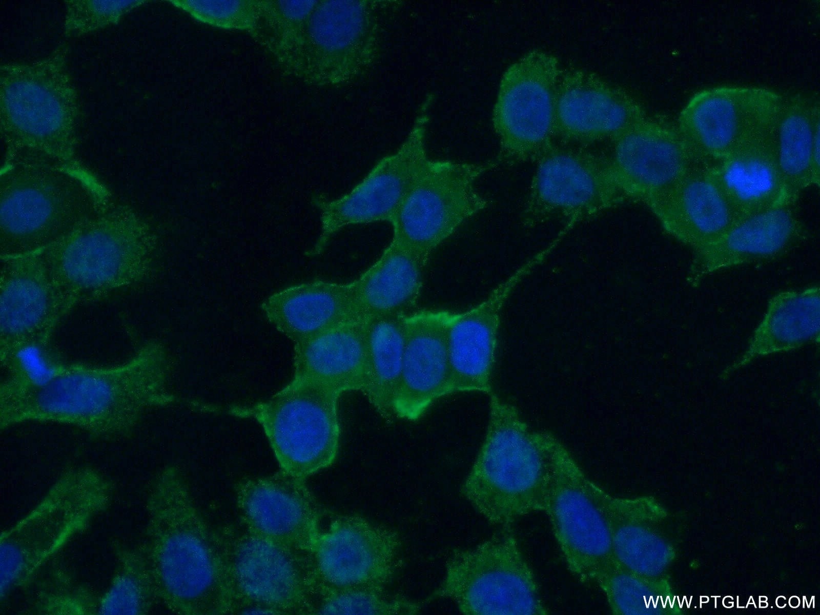Immunofluorescence (IF) / fluorescent staining of MCF-7 cells using AMIGO3 Polyclonal antibody (21278-1-AP)