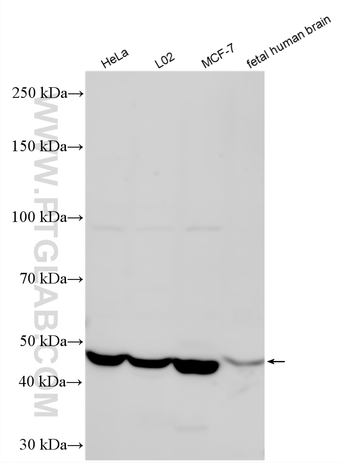 Western Blot (WB) analysis of various lysates using AMIGO3 Polyclonal antibody (21278-1-AP)