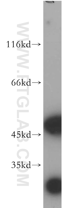 Western Blot (WB) analysis of HeLa cells using AMIGO3 Polyclonal antibody (21278-1-AP)