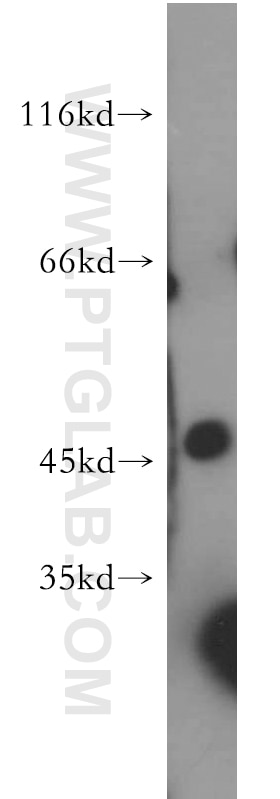 Western Blot (WB) analysis of human brain tissue using AMIGO3 Polyclonal antibody (21278-1-AP)