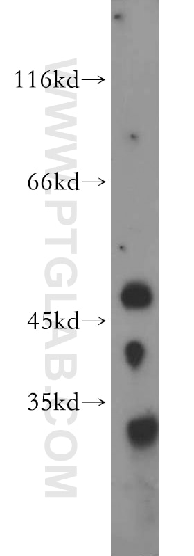 Western Blot (WB) analysis of mouse ovary tissue using AMIGO3 Polyclonal antibody (21278-1-AP)