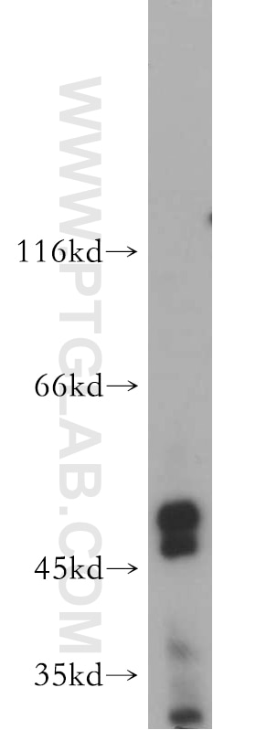 Western Blot (WB) analysis of MCF-7 cells using AMIGO3 Polyclonal antibody (21278-1-AP)
