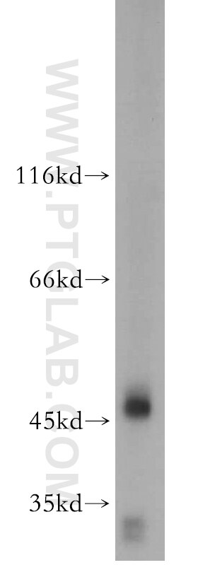 Western Blot (WB) analysis of mouse kidney tissue using AMIGO3 Polyclonal antibody (21278-1-AP)