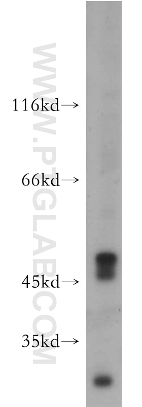 Western Blot (WB) analysis of L02 cells using AMIGO3 Polyclonal antibody (21278-1-AP)