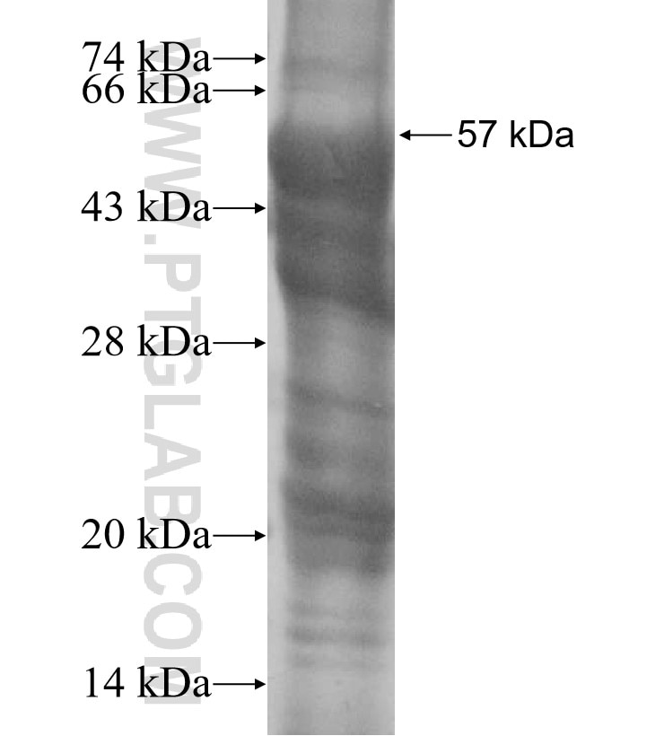 AMIGO3 fusion protein Ag15790 SDS-PAGE
