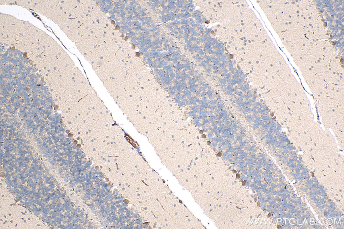 Immunohistochemistry (IHC) staining of mouse cerebellum tissue using AMMECR1 Polyclonal antibody (24687-1-AP)