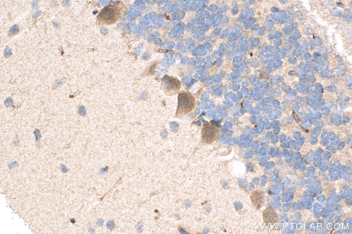 Immunohistochemistry (IHC) staining of mouse cerebellum tissue using AMMECR1 Polyclonal antibody (24687-1-AP)