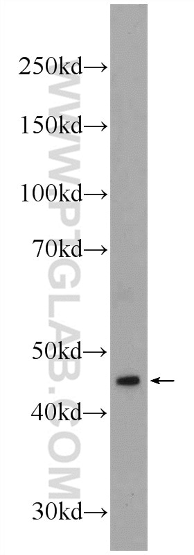 Western Blot (WB) analysis of mouse uterus tissue using AMMECR1 Polyclonal antibody (24687-1-AP)