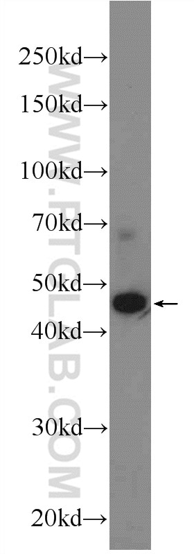 Western Blot (WB) analysis of Jurkat cells using AMMECR1 Polyclonal antibody (24687-1-AP)