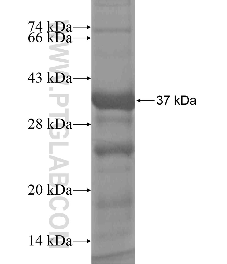 AMMECR1 fusion protein Ag16977 SDS-PAGE