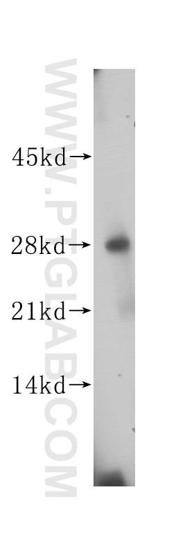 Western Blot (WB) analysis of human colon tissue using AMN1 Polyclonal antibody (14694-1-AP)