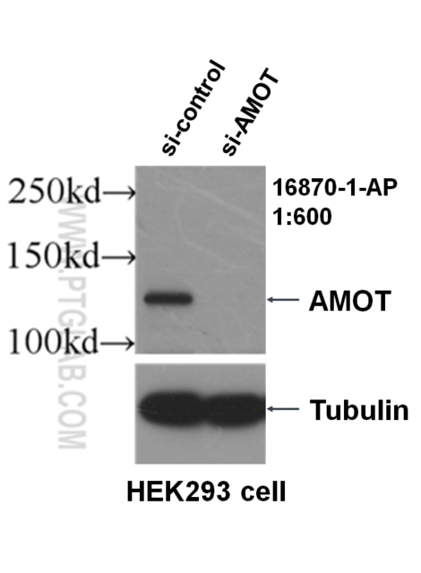 Western Blot (WB) analysis of HEK-293 cells using AMOT Polyclonal antibody (16870-1-AP)
