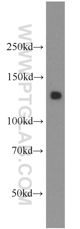 Western Blot (WB) analysis of human stomach tissue using AMOT Polyclonal antibody (16870-1-AP)