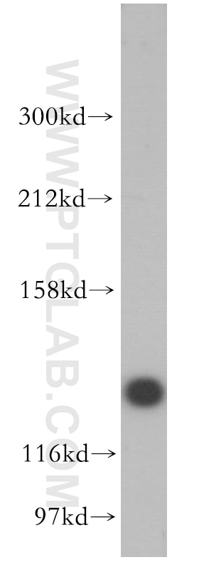 Western Blot (WB) analysis of human stomach tissue using AMOT Polyclonal antibody (16870-1-AP)