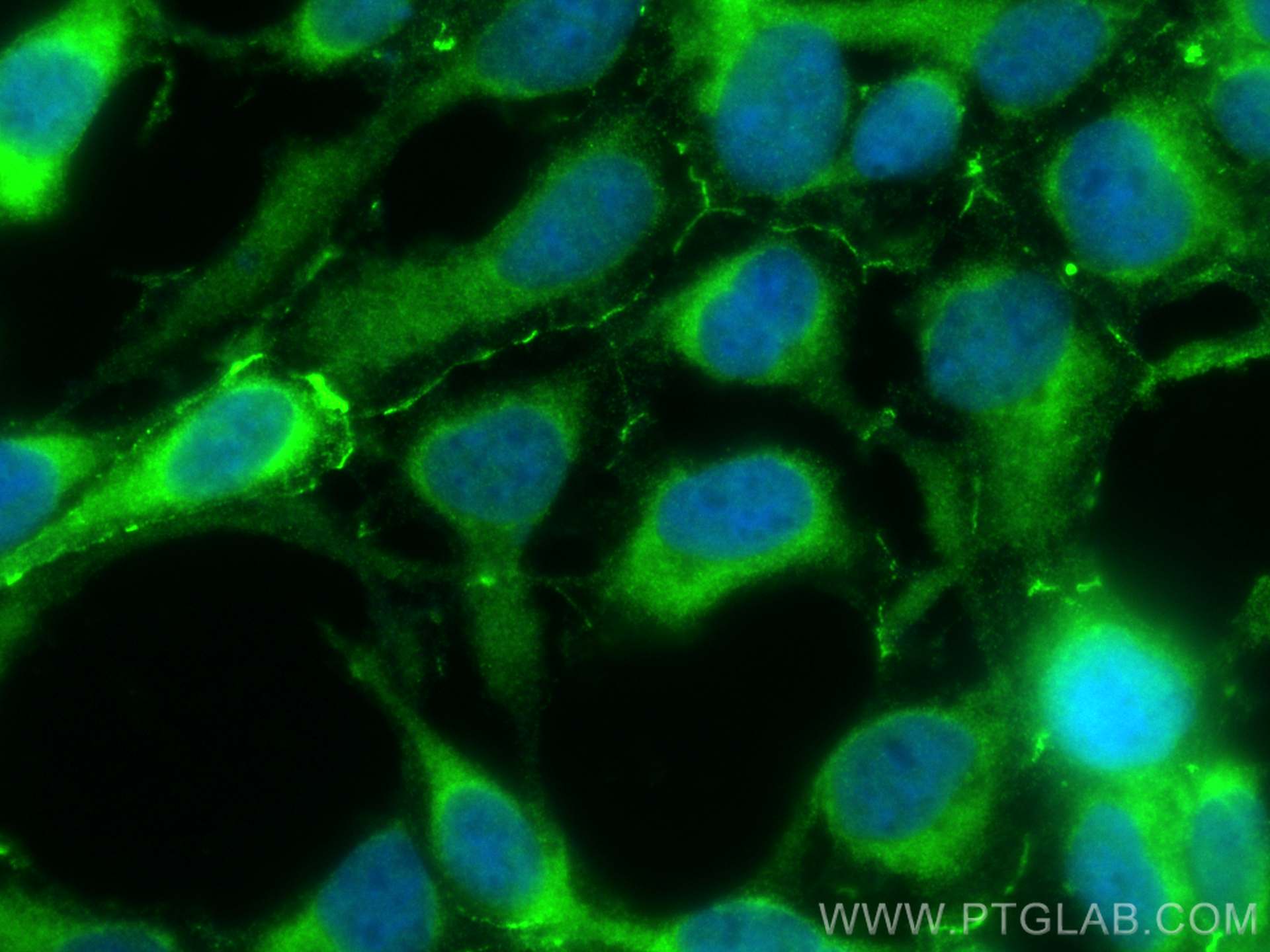 Immunofluorescence (IF) / fluorescent staining of HEK-293 cells using AMOT Polyclonal antibody (24550-1-AP)