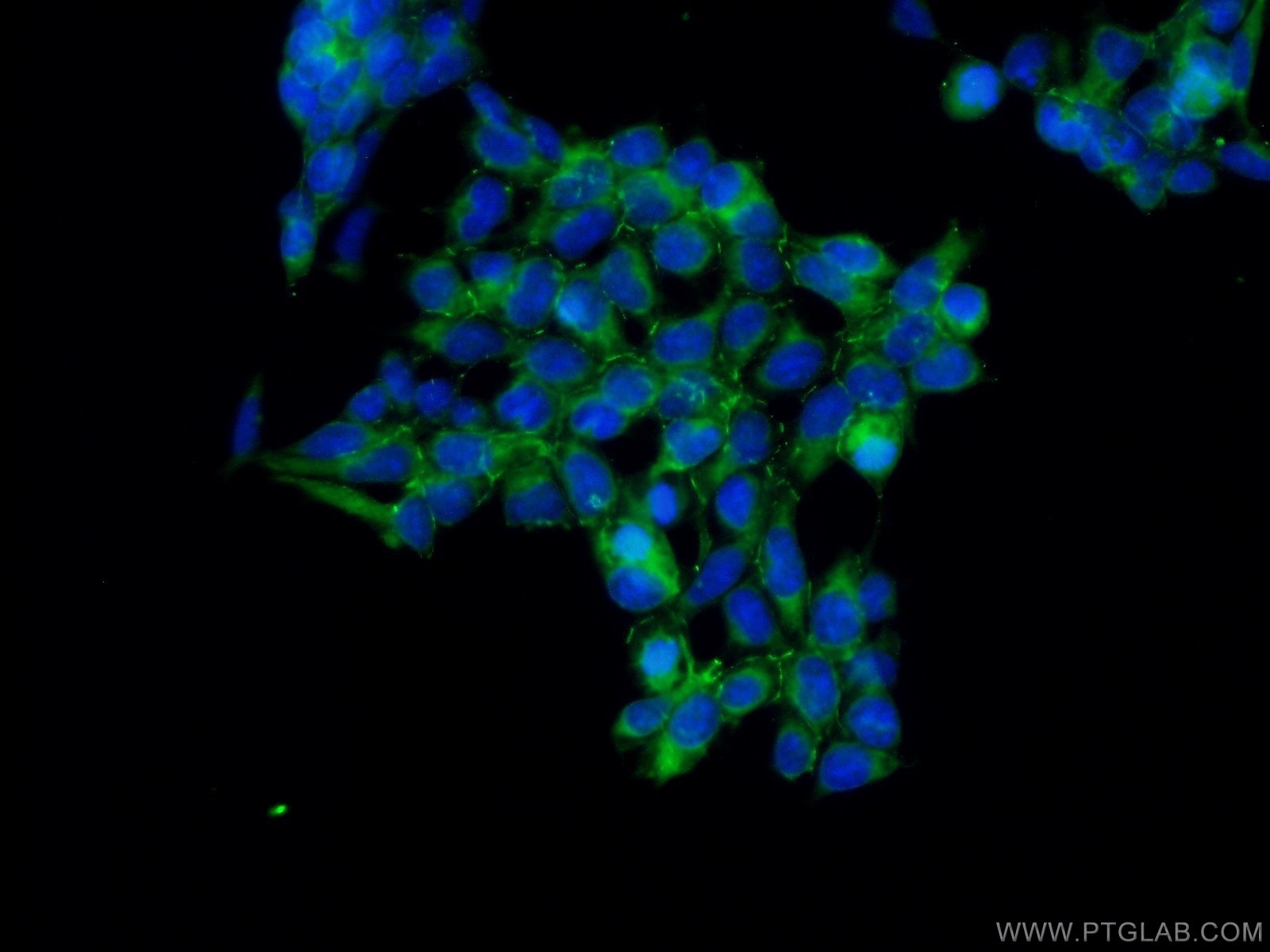 Immunofluorescence (IF) / fluorescent staining of HEK-293 cells using AMOT Polyclonal antibody (24550-1-AP)