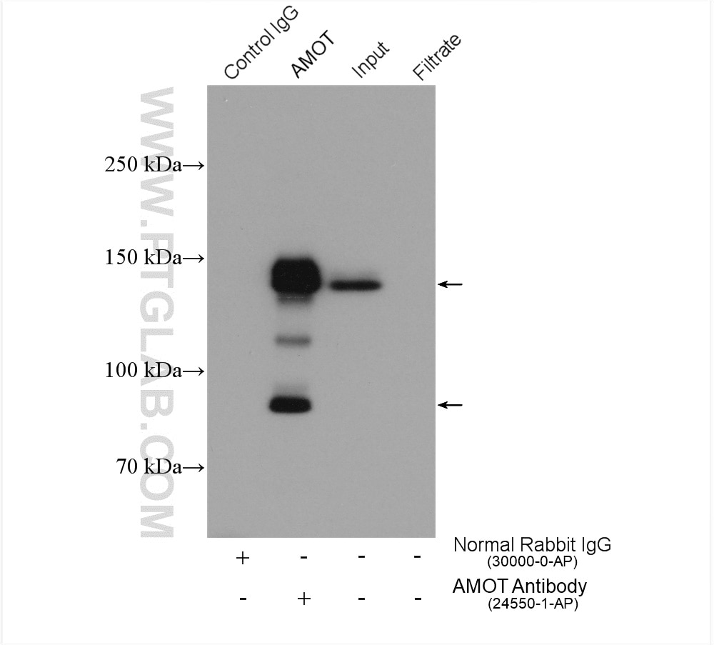 Immunoprecipitation (IP) experiment of HEK-293 cells using AMOT Polyclonal antibody (24550-1-AP)