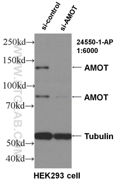Western Blot (WB) analysis of HEK-293 cells using AMOT Polyclonal antibody (24550-1-AP)
