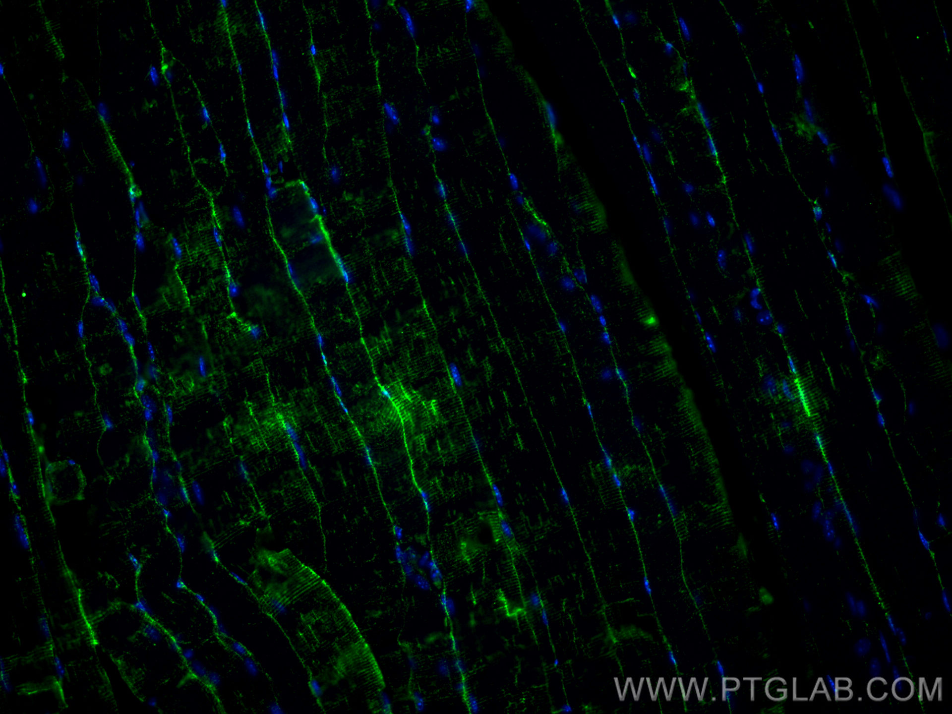 Immunofluorescence (IF) / fluorescent staining of mouse skeletal muscle tissue using AMOT Monoclonal antibody (60156-1-Ig)