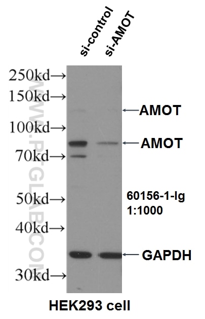 WB analysis of HEK-293 using 60156-1-Ig